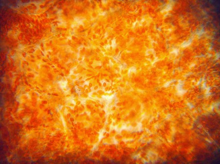 Cellule vegetali_cromoplasti di peperone giallo_40 x
